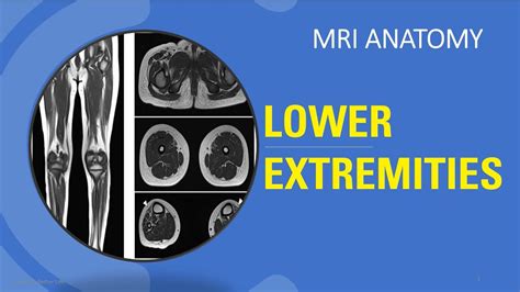 Mri Board Review Lower Extremities Anatomy Youtube