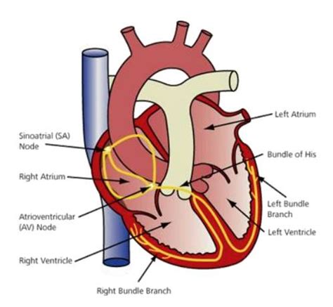 Cardiac Angiography Unit Pacemaker Implant Pre Procedure Leaflet