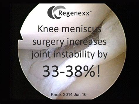 Does Meniscus Surgery Help? Taking Out a Torn Meniscus Makes the Knee ...