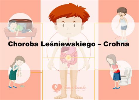 Choroba Leśniewskiego Crohna czym jest Jak leczyć