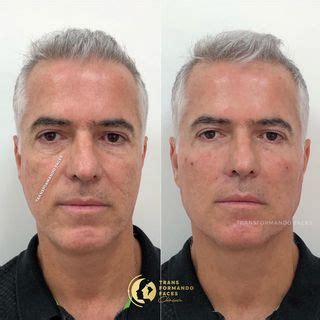 Clínica Transformando Faces clinicatransformandofaces Instagram