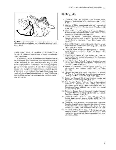 Fundamentos Esenciales En Protesis Fija Shillingburg PDF