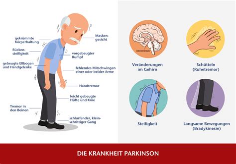 Professionelle Parkinson Pflege Leitfaden für Fachkräfte