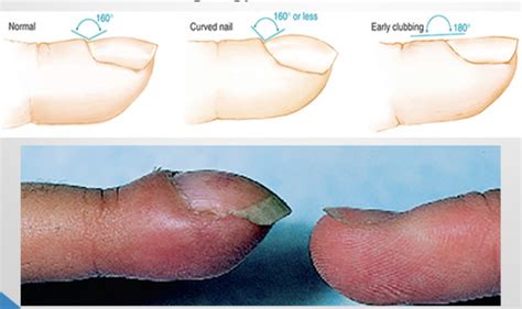 Skin Hair And Nail Assessment Flashcards Quizlet