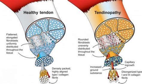 Blog Set In Motion Physiotherapy