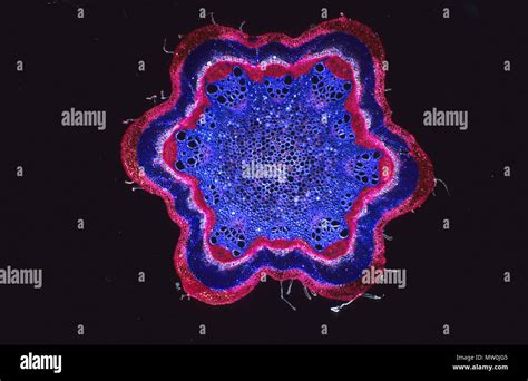 Xylem micrograph hi-res stock photography and images - Alamy