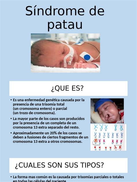 Tratamentos Para Síndrome De Patau - Síndrome de Patau | PDF | Salud y bienestar | Ciencia y matemáticas