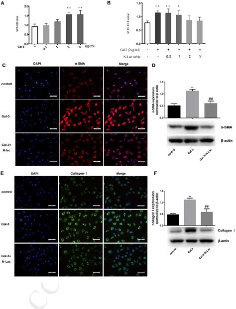 Figure 3 From Galectin 3 Mediates Pulmonary Vascular Remodeling In