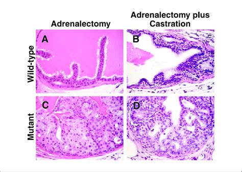 Androgen Independent Lesions Following Adrenalectomy And Castration