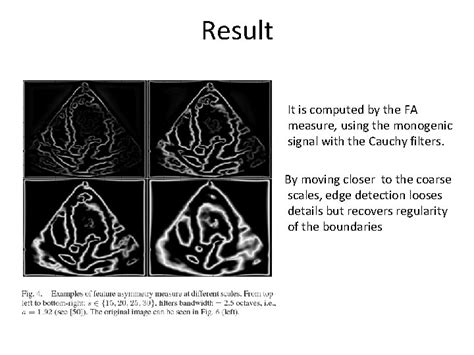 PhaseBased Level Set Segmentation Of Ultrasound Images Author