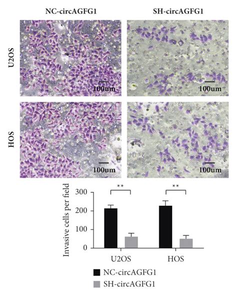 Circagfg1 Drives Osteosarcoma Cell Proliferation Migration Invasion