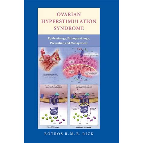 Ovarian Hyperstimulation Syndrome No Shoptime