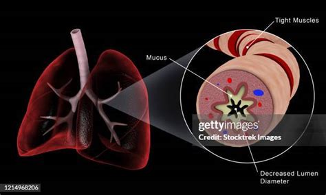 Mucus Plug Photos and Premium High Res Pictures - Getty Images