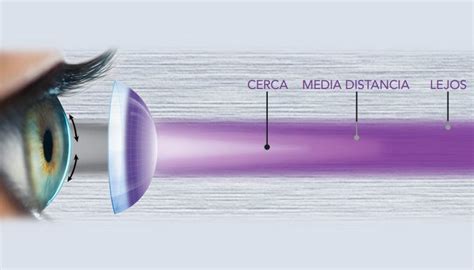 Lentillas multifocales ver bien a cualquier distancia Boa Visión