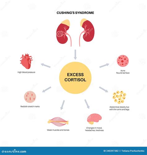 Cushings Syndrome Excess Cortisol Production Male Figure With