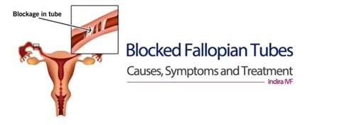 Blocked Fallopian Tubes Symptoms Causes And Treatment The Good News Blog