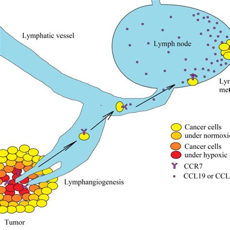 Two Types Of Hypoxia In A Tumor Chronic Hypoxia Is Associated With A