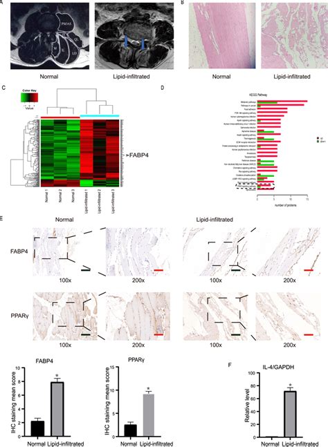 Expression Levels Of Fabp And Ppar In Lipid Infiltrated Muscles Were