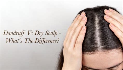 What causes a dry scalp? What's the difference amongst a dry scalp vs ...
