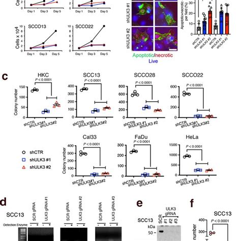 The Proliferative Potential Of HKCs And SCC Cells Is Suppressed By ULK3