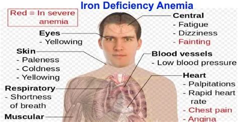 What is Anisocytosis ? Causes, Types and Vs Poikilocytosis ...