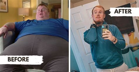 Casey King Weight Loss Transformation 600 Lbs Down