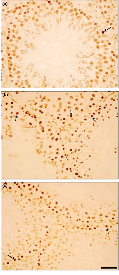 Terminal Dutp Nick End Labelling Tunel Staining Of Testis In Control