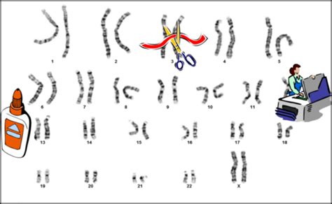 What is a Chromosome 18 abnormality? - Chromosome 18