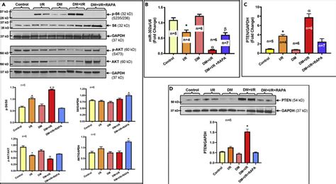 Rapamycin Differentially Regulates Mtorc And Mtorc In Diabetic