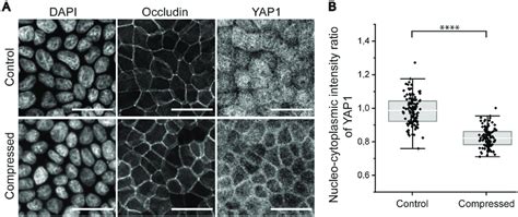 Nucleo Cytoplasmic Distribution Of Yap A Immunofluorescence