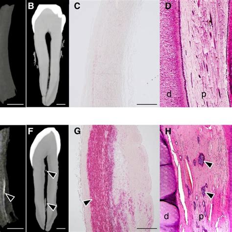 Micro Computed Tomography Ct And Histological Observations Of The