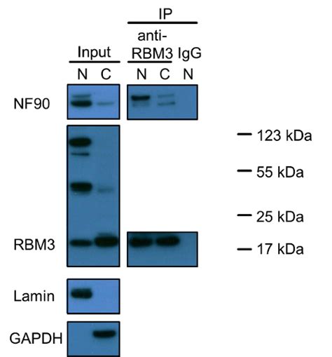 Visualization Of Protein Protein Interaction In Nuclear And Cytoplasmic