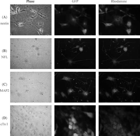 The Expressions Of Lineage Specific Markers In The Differentiated Cells