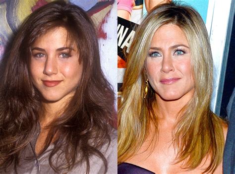 Jennifer Aniston from Celebrities Who Got a Nose Job to Fix Their ...