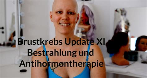 Brustkrebs Update Bestrahlung Und Antihormontherapie