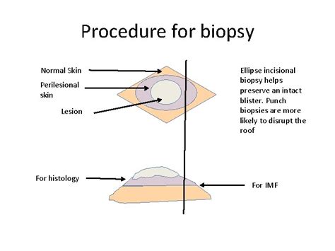 Immunofluorescence And Skin Biopsies Dr Claire Murray Procedure