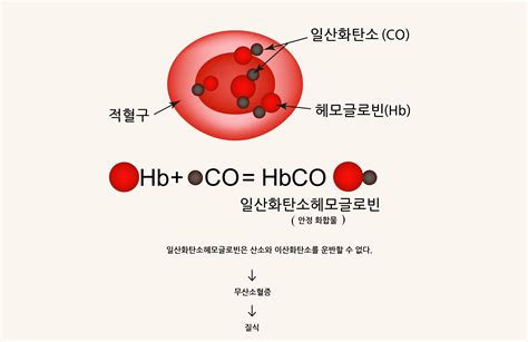 판결 욕창성 및 압박 부위 궤양도 일산화탄소 중독으로 생긴 상해 또는 그 합병증이면 질병 보장 안돼 Lawpiplcom