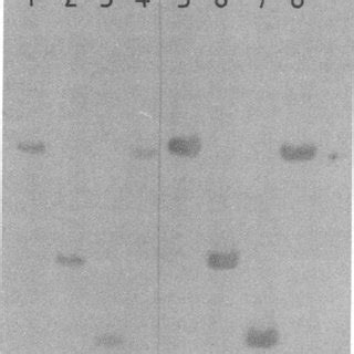 DNA DNA Hybridization With Digoxigenin Labeled Probe Of The DhlA Gene