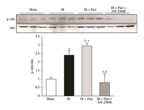 Paricalcitol Enhanced Akt Phosphorylation And Inhibited P Nf B