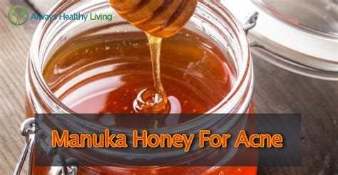 How To Use Manuka Honey For Acne treatment - Always Healthy Living