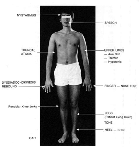 Examination of Cerebellum | CEO | Clinical Examination Online