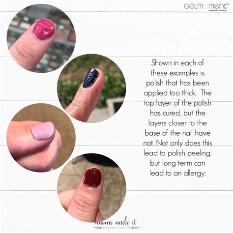 how to treat an allergic reaction to gel nail polish 8