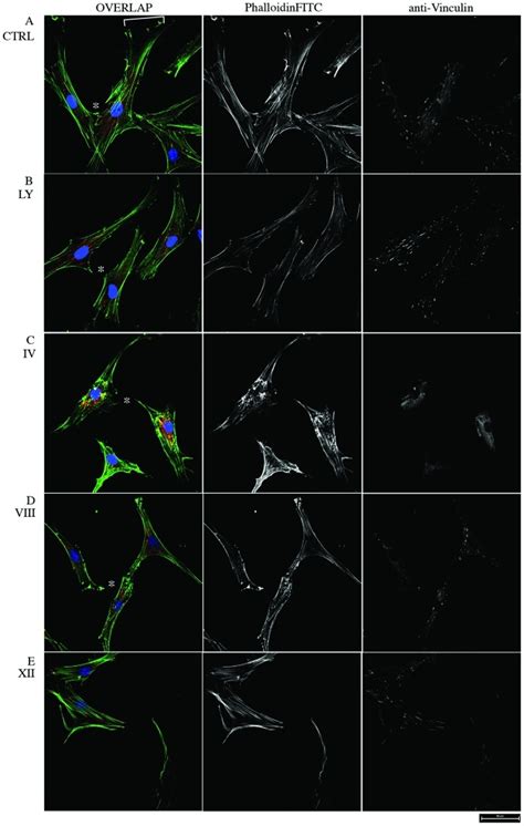 Cytoskeletal Remodeling Of Msc Exposed To Pi3kakt Inhibitors A