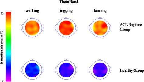 Topographical Maps Of The Spectral Theta Band It Was Ln Transformed In