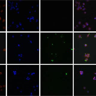 Affinity Analysis In Aspc By Immunofluorescence Cells Were Untreated