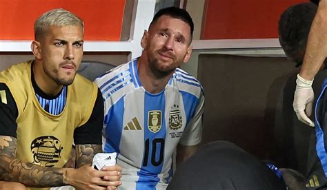 FOTO Impactante Así quedo el tobillo de Lionel Messi Central Noticia