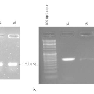 Agarose Gel Electrophoresis Pre Stained With Ethidium Bromide Etbr