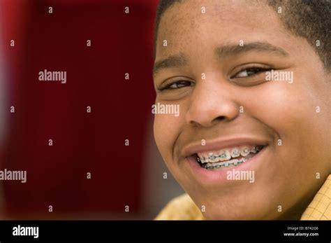 Portrait Of African Boy With Braces Stock Photo Alamy