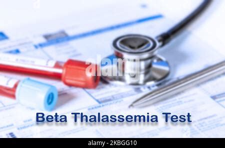 Beta Thalassemia Test Medical Check Up Test Tube With Biological Sample