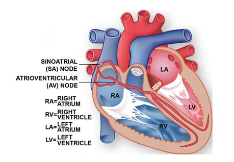 An Overview of the Workings and Afflictions of the SA Node | by Michelle White | Medical CPS ...